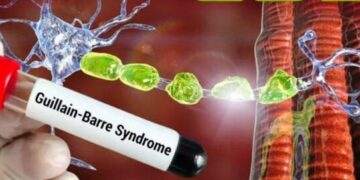 अहिल्यानगरमध्ये आढळले ‘जीबीएस’ संशयित चार रुग्ण